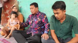 Bupati Tangerang, Moch. Maesyal Rasyid, mengunjungi SM, anak berusia 4 tahun yang menderita retinoblastoma (kanker mata) di Desa Pagenjahan, Kecamatan Kronjo(dok. istimewa)