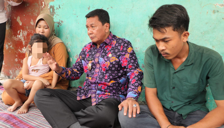 Bupati Tangerang, Moch. Maesyal Rasyid, mengunjungi SM, anak berusia 4 tahun yang menderita retinoblastoma (kanker mata) di Desa Pagenjahan, Kecamatan Kronjo(dok. istimewa)