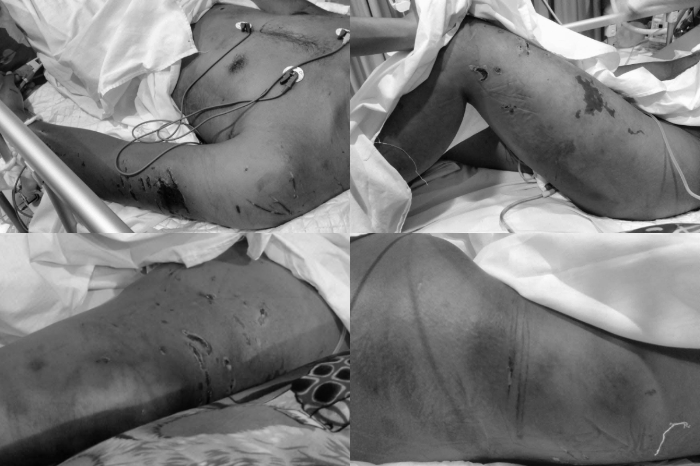 Prada Lucky tewas usai diduga dianiaya oleh seniornya. Gubernur NTT pastikan keluarga dapat keadilan, 20 prajurit TNI sudah ditahan dan diperiksa.