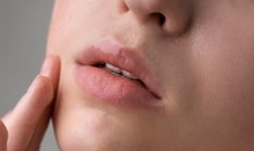 Cara Alami Mengatasi Pigmentasi Bibir agar Lebih Cerah