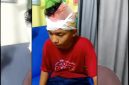 Anur Rahman Rizkia, korban tawuran pelajar di Pagelaran, Pandeglang, saat menjalani perawatan medis akibat luka sabetan senjata tajam di bagian kepala dan tangan.