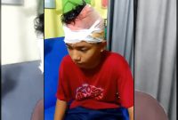 Anur Rahman Rizkia, korban tawuran pelajar di Pagelaran, Pandeglang, saat menjalani perawatan medis akibat luka sabetan senjata tajam di bagian kepala dan tangan.