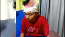 Anur Rahman Rizkia, korban tawuran pelajar di Pagelaran, Pandeglang, saat menjalani perawatan medis akibat luka sabetan senjata tajam di bagian kepala dan tangan.
