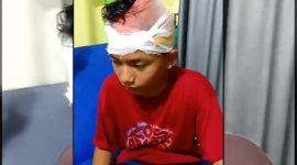 Anur Rahman Rizkia, korban tawuran pelajar di Pagelaran, Pandeglang, saat menjalani perawatan medis akibat luka sabetan senjata tajam di bagian kepala dan tangan.