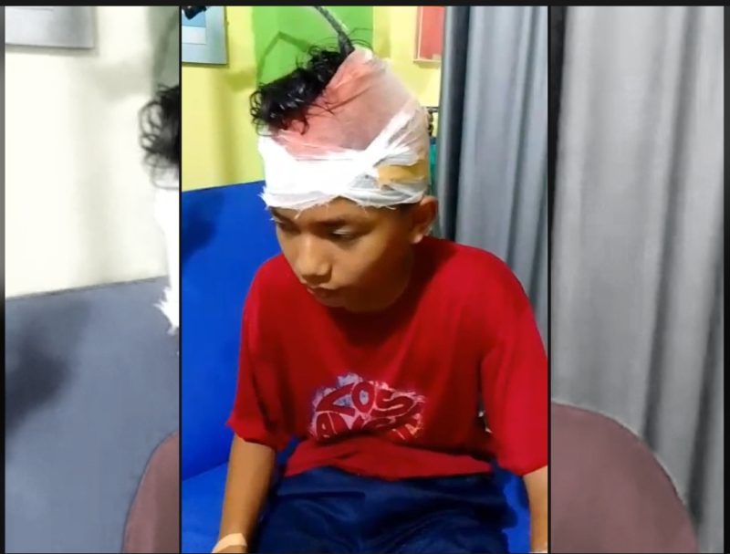 Anur Rahman Rizkia, korban tawuran pelajar di Pagelaran, Pandeglang, saat menjalani perawatan medis akibat luka sabetan senjata tajam di bagian kepala dan tangan.